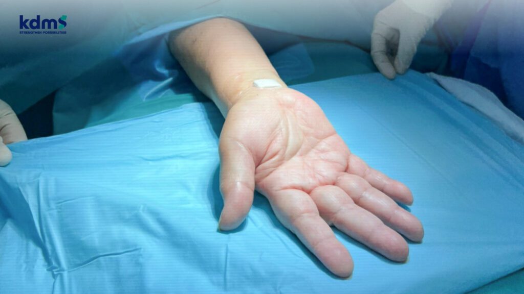 การรักษาแบบผ่าตัดพังผืดที่ข้อมือ